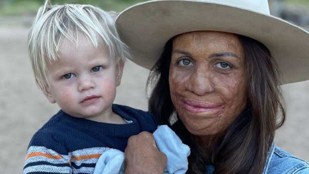 Turia Pitt and her second child, Rahiti