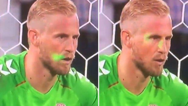 A laser is shined on Kasper Schmeichel's face.