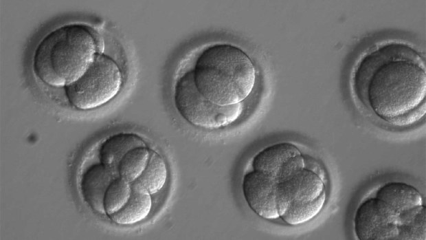 Human embryos in a laboratory prior to being implanted.
