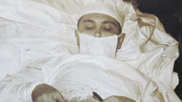 Leonid Rogozov had no choice but to cut out his own appendix.
