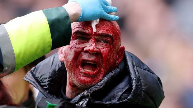 A fan with a bloodied face is escorted away by local police during the Emirates FA Cup Fourth Round match between West Bromwich Albion and Wolverhampton Wanderers at The Hawthorns on January 28, 2024 in West Bromwich, England. (Photo by Getty Images/Getty Images)