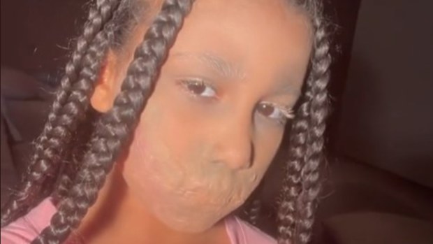 North West with special effects makeup on her mouth.