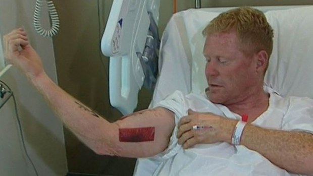 Last month, a mine worker had a shark latch onto his arm off a NSW nudist beach.