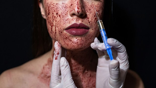 Vampire Facial