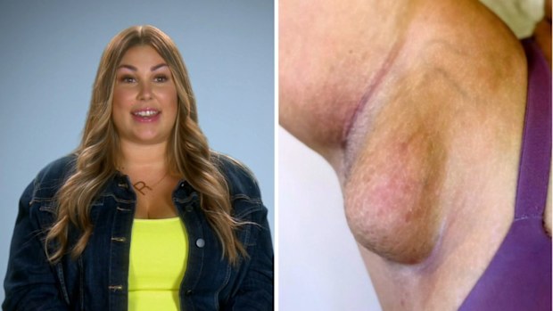 Botched, 9Now