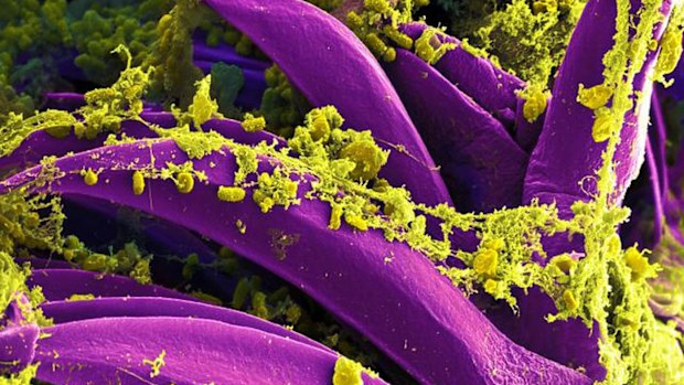 The plague