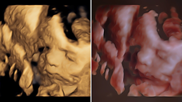 MAFS Jules Robinson Cam Merchant baby scans