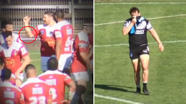 Beau Henry is sent off for wiping blood on his opponent.