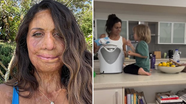 Turia Pitt