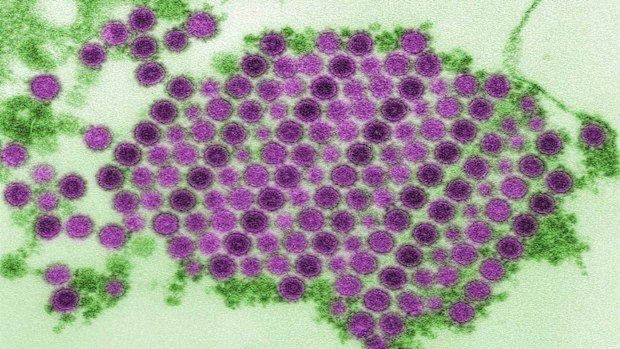 Chikungunya virus as seen through a microscope.