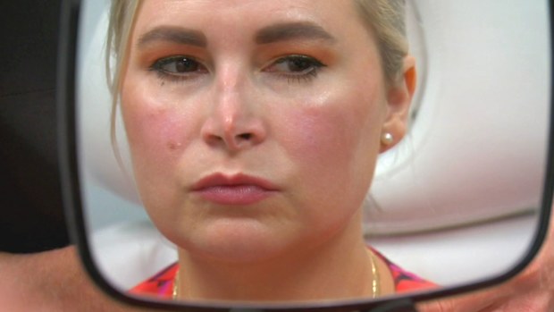 Botched Holly nose job