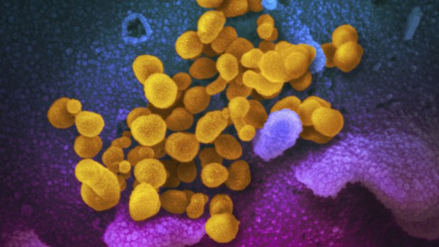 Also known as 2019-nCoV, the virus causes COVID-19.