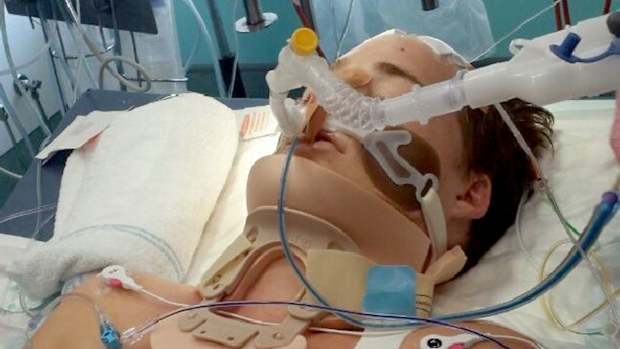Michael McEwen was in a coma for eight days after a coward punch attack in December 2013. (Supplied)