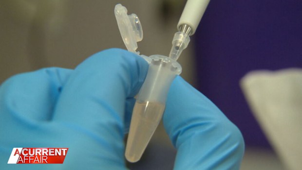 A potentially groundbreaking new blood test to help detect breast cancer could soon be launched in Australia.