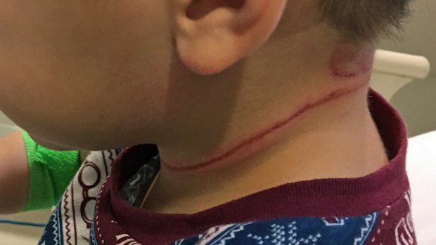 Mum’s terrifying warning after toddler nearly dies from blind cord 