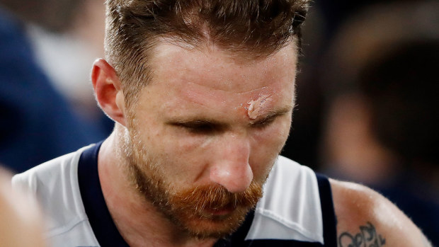 Zach Tuohy's forehead moments after the incident