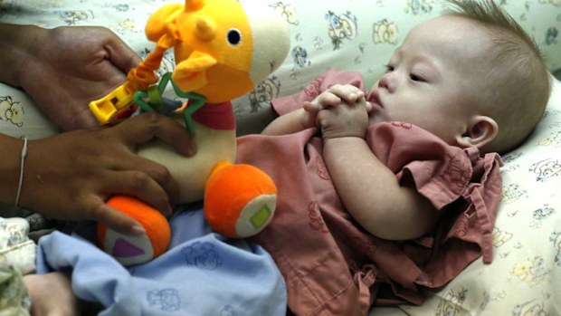 Baby Gammy now lives in Thailand with his surrogate mother.