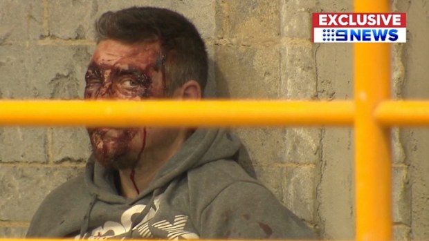 Dick was left bloodied in the scuffle.