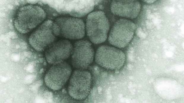 The smallpox virus seen under a microscope. (AAP)