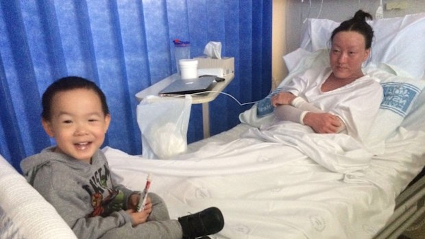 2 weeks in hospital for wet wrapping treatment, swelling on face and limbs, separated from family.