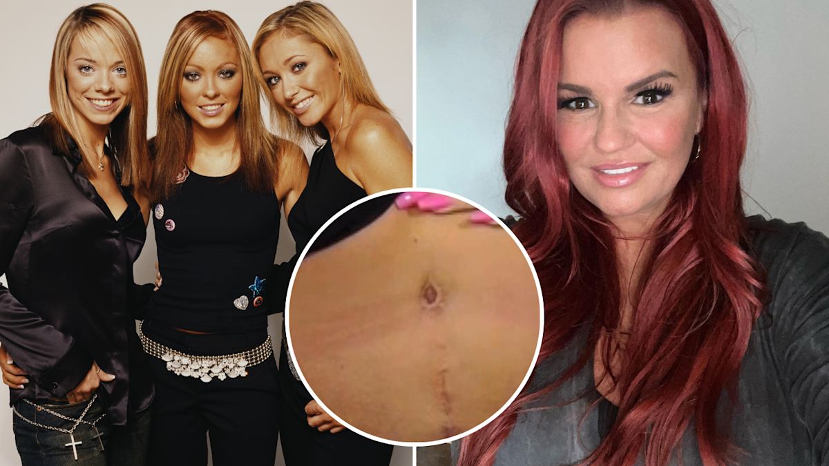 Former Atomic Kitten singer Kerry Katona reveals botched secret tummy ...