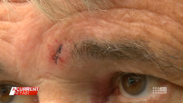David Winter claimed he was headbutted.