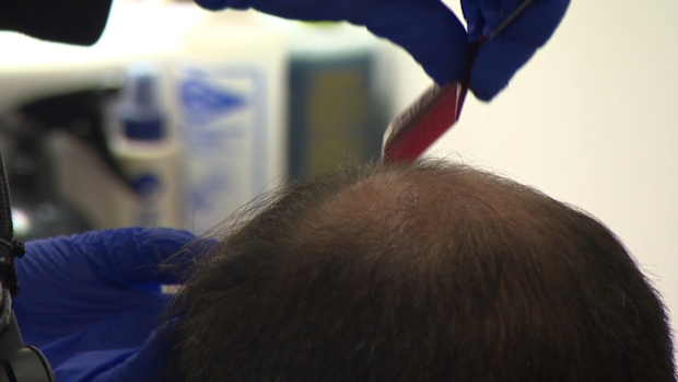A man with thinning hair.