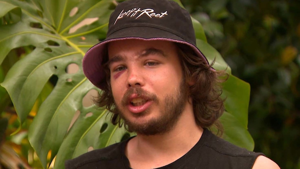 Melbourne tradie left with serious injuries after road rage attack by e ...