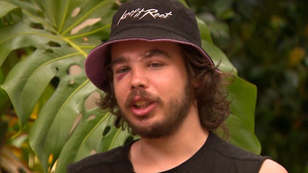 A Melbourne tradie has been left with serious injuries to his face after being attacked by an e-scooter rider in a road rage incident.Tyler Macaloney was driving home from his panel beating job in Parkville on Friday when he was confronted by a man who was weaving in and out of traffic.
