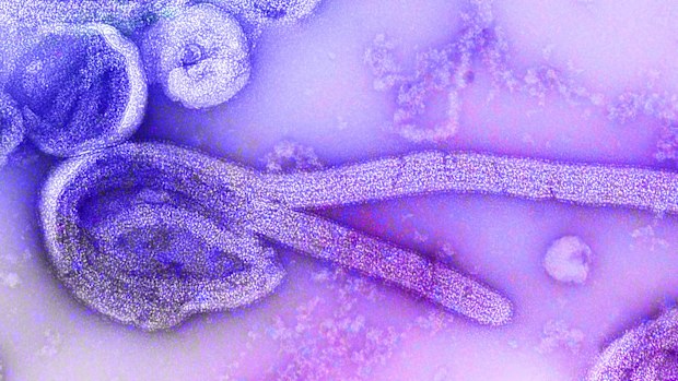 An electron microscopic image of an isolate of Marburg virus