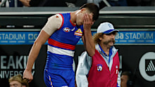 GEELONG, AUSTRALIA - APRIL 17: Sam Darcy of the Bulldogs is seen with Club Doctor Gary Zimmerman during the 2026 AFL Round 06 match between the Geelong Cats and the Western Bulldogs at GMHBA Stadium on April 17, 2026 in Geelong, Australia. (Photo by Michael Willson/AFL Photos via Getty Images)