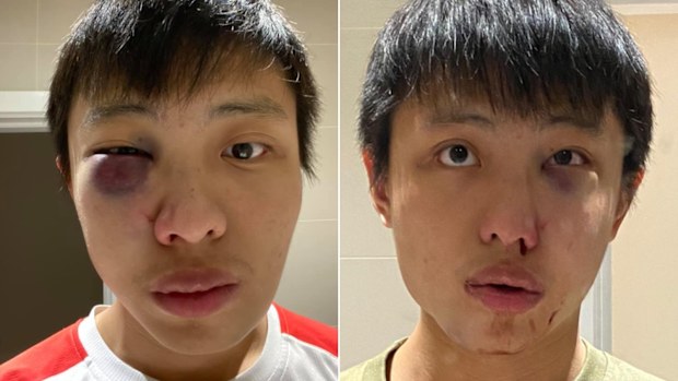 Jonathon Mok says he was attacked by a group of thugs in a busy London street.