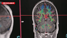 A 35-year-old man who had a stroke is in intensive care after updated results of his CT scan were not passed on, 9News can reveal.