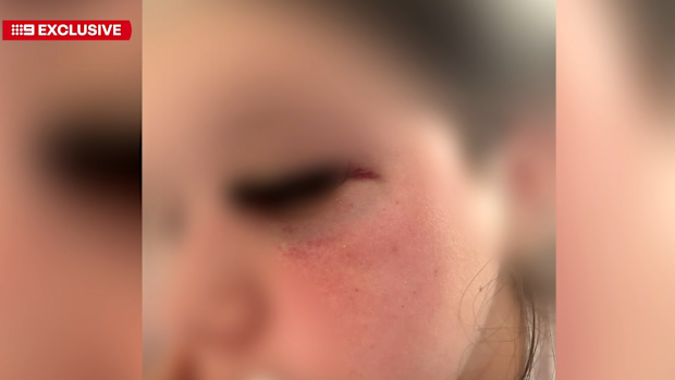 Shellharbour: Mum wants charges laid after after-school attack on girl ...