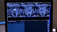 More men will be tested for prostate cancer as part of world-first reforms to boost early detection.