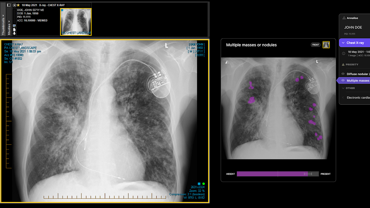 South Australia Medical Imaging clinics roll-out Artificial ...