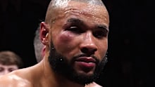 Cropped; Chris Eubank Jr with an injury to his right cheek following defeat to Liam Smith in the middleweight bout at the AO Arena, Manchester. Picture date: Saturday January 21, 2023. (Photo by Nick Potts/PA Images via Getty Images)