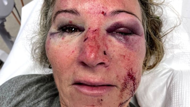 Sydney women reveal miraculous survival story following brutal, random ...