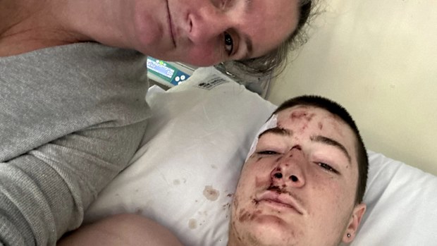 Aiyden O'Donoghue, now 16, was nearly killed after hanging off a train as part of a social media trend called 'buffer riding' last year.O'Donoghue had broken into the back carriage of a train as it passed Bankstown Station to participate in the trend, which consists of hanging from the back of a moving train.