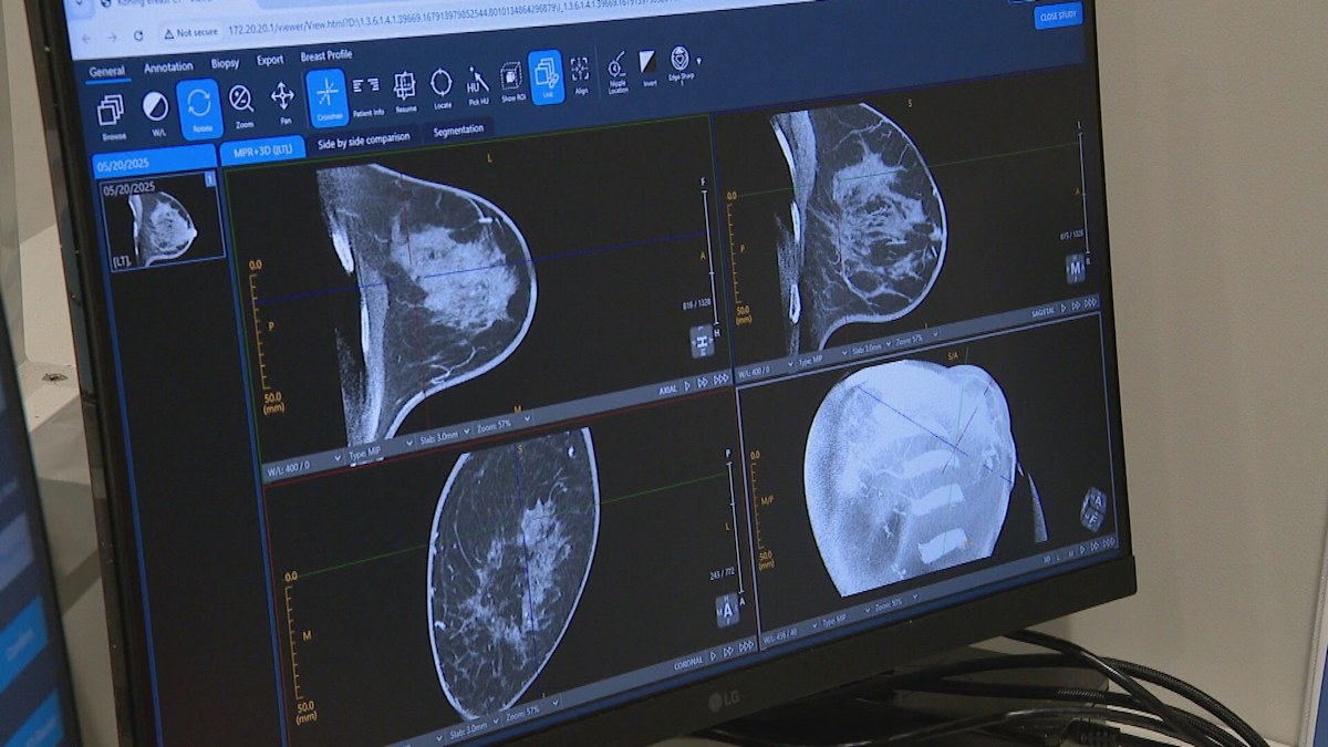 Brisbane clinic offering new pain-free breast screen technology | Nine ...