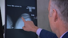 Experts are concerned people with osteoarthritis are resorting to quick-fix treatments that are not recommended in the clinic.