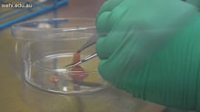 The organoids are the size of grain of sand and a special robot is used to screen which treatment kills off the tumour more effectively.
