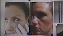 The 43-year-old kept her injuries a secret, concealing her black eyes and scars with makeup.