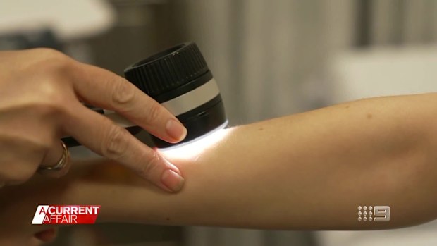 Melanoma experts harbour concerns about changes to sun safety guidelines
