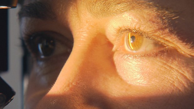 Experts warn against eye cancer affecting hundreds of Queenslanders every year
