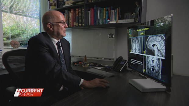 New study looks into treating OCD with pacemakers