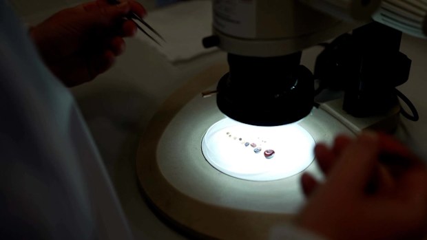 Killed by a tick: The tragic death of 16-year-old Jeremy Webb