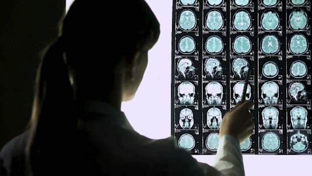 New scanning tool could help paramedics identify a stroke in seconds