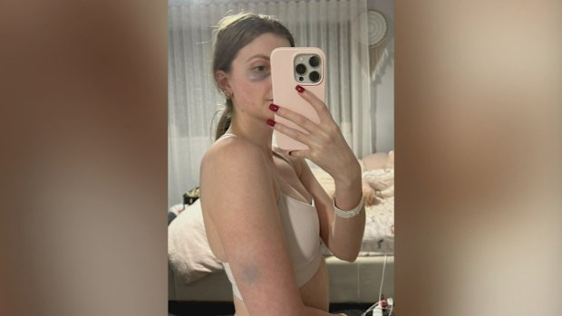 An Adelaide woman Breana Coats was allegedly randomly attacked by two teenage girls who demanded a vape while she was running yesterday afternoon, 9News can reveal.