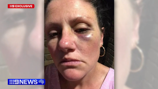Terry Phillips: Domestic violence survivor calls for her abuser to be ...